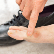 Schoenen voor hallux valgus